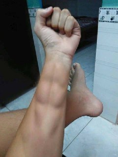 [photo](media:AgACAgEAAx0CPmz7HwABA6fDXyv3NOzdICYfNSP24hTvRBnxH5wAAtuoMRv6cGBFhXYRXeoxM4UKvm4GAAQBAAMCAANtAAMRJgQAARoE@telegram)