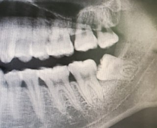 [photo](media:AgACAgUAAx0CPmz7HwABBCpqYGMDryZVRVwn70_gdNR7xERCT8oAAh-sMRs38RlXYF8xAAF4EwvFQ8YYb3QAAwEAAwIAA20AA7lIAwABHgQ@telegram)