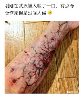 [photo](media:AgACAgUAAx0CPyvoigABAs2cXikJdEHIK_6O1jRJ7OaWeHhPcE8AAu-qMRu3mEFVtDbPuU9FzshLHxszAAQBAAMCAANtAAOhHQMAARgE@telegram)