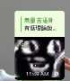 [photo](media:AgADBQADuKcxG2CfwFYCZaIxtBjexH5GyjIABPxdc25EEO8G_kAEAAEC@telegram)